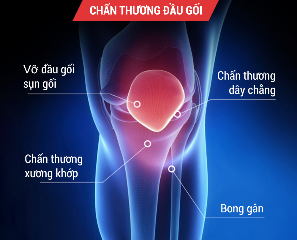 bó gối thể thao bó gối thể thao