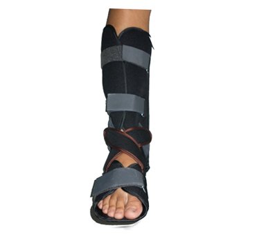 Nẹp cẳng chân ngắn Nẹp cẳng chân ngắn